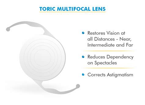 Toric Multifocal Contact Lenses For Astigmatism | edu.svet.gob.gt