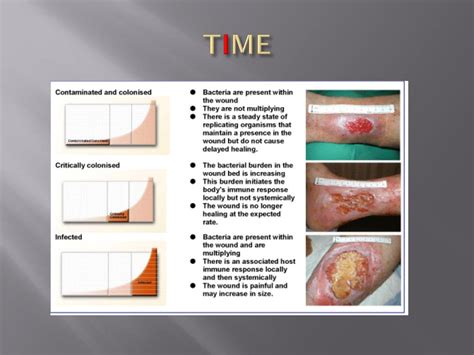 PPT - Wound management using ‘TIME’ PowerPoint Presentation, free ...