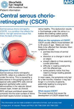 Central serous chorio-retinopathy (CSCR) - Moorfields Eye ...