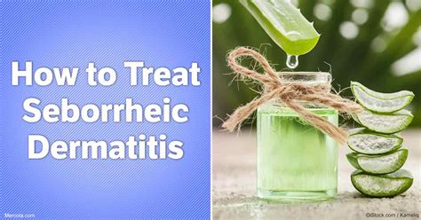 How to Treat Seborrheic Dermatitis