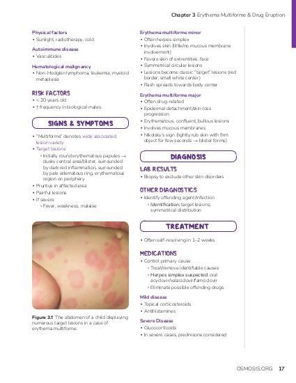 Stevens-Johnson syndrome: Video, Causes, & Meaning | Osmosis