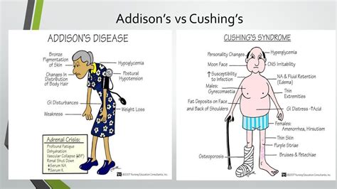 Cushing's and Addison's Disease Diagram | Quizlet