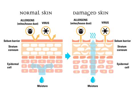 WHY DO YOU HAVE A SKIN BARRIER | Hóa học