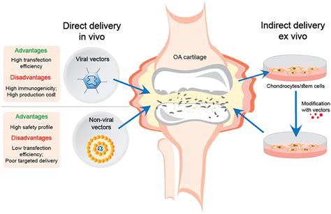 Osteoarthritis Treatment