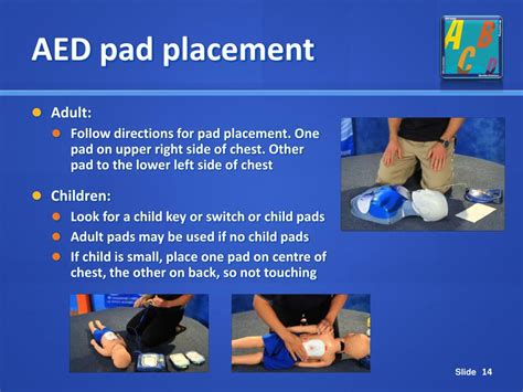 Anteroposterior Aed Placement