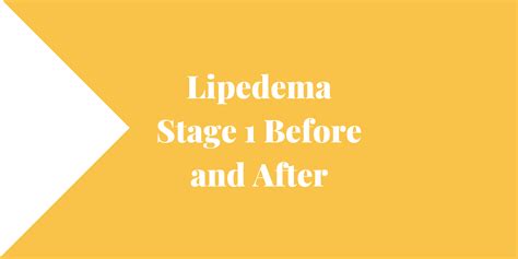 Lipedema Stage 1 Before and After - Lipedema and Me