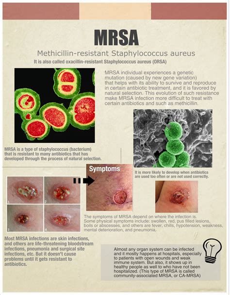 More MRSA Info For Your Health - Country Foot Care