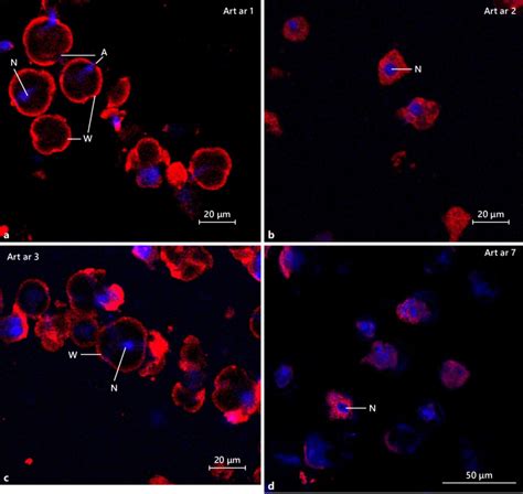 Confocal laser scanning microscopy showing the immunofluorescence (Cy3 ...