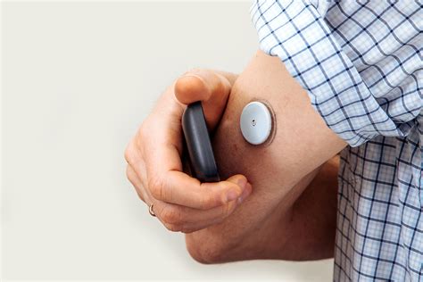 Continuous Glucose Monitoring: Evolving Evidence for Technology - MCG Health