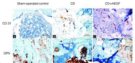 Immunohistochemical staining of CD31 (A-C) and OPN (D-F) in infarcted ...