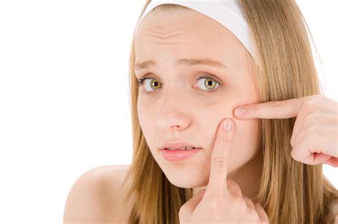 Acne in Teenagers | Short Hills Dermatology