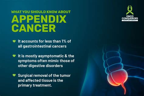 Nine warning signs of Appendix Cancer - Healthstory