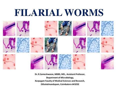 Filarial worms dr. rs 28 08-2017