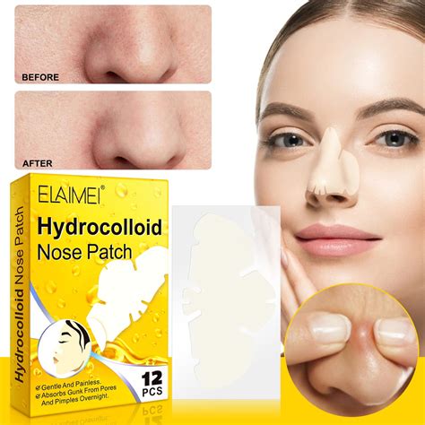 NuoWeiTong Remove Blackheads From Face,Hydrocolloid Removes Blackheads ...