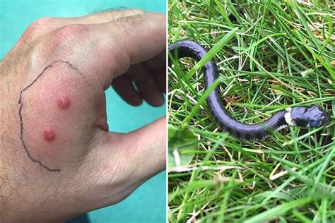 Horrified dad 'bitten by a snake after finding 15 of the slithering beasts in a nest with eggs ...