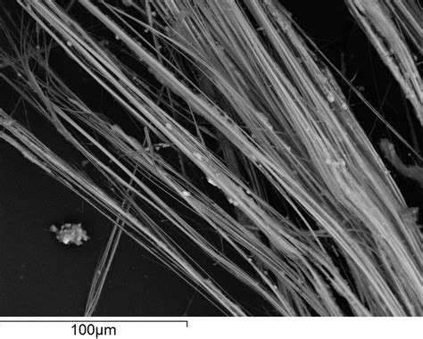 Asbestos Fibers Under Microscope