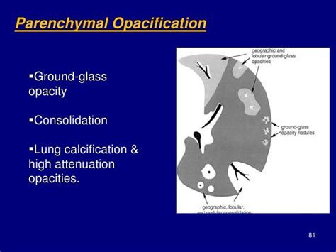 Technical aspect of hrct; normal lung anatomy & hrct findings of lung…