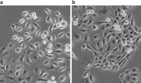 Growth and differentiation of HaCaT keratinocytes. | Semantic Scholar