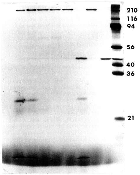 Background incorporation in the nuclease-treated lysate. A ...