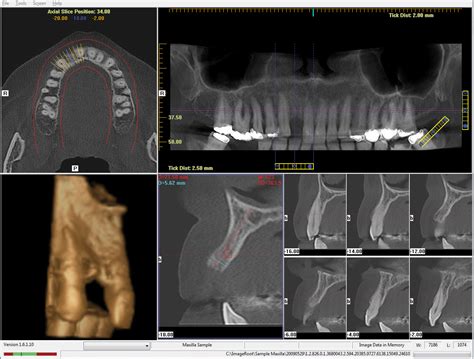 I-CAT Vision - Dental Scanning Services - CT Dent Ltd