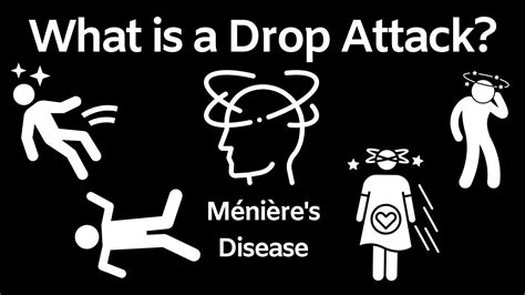 Meniere Disease Drop Attacks - Captions Energy