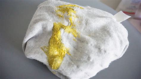 How to get yellow poop stains out of clothes - Aseky + Co.