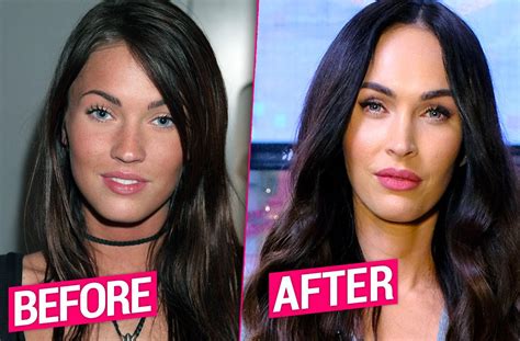 Megan Fox Plastic Surgery Transformation Revealed By Top Doctors