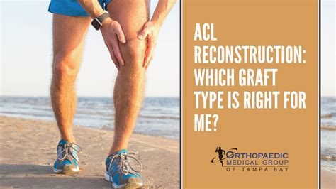 ACL Reconstruction: Which Graft Type is Right for Me? - OMG Tampa Bay