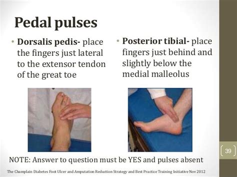 Posterior Tibialis Pulse