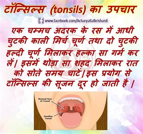 Tonsils | Natural remedies health, Health knowledge, Health facts