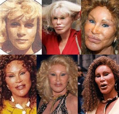 » Jocelyn Wildenstein Before and After Plastic Surgery