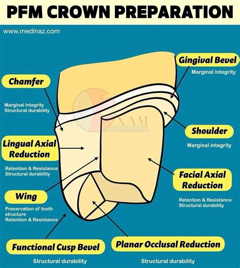 PFM Crown Preparation - MEDizzy