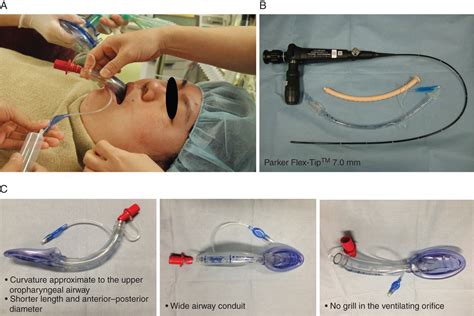 Intubating Laryngeal Mask Airway