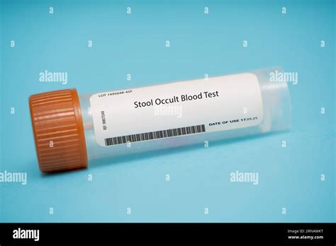 Stool Occult Blood Test This test looks for the presence of hidden (occult) blood in the stool ...