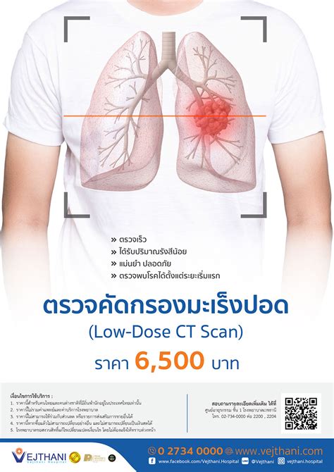 ตรวจคัดกรองมะเร็งปอด (Low-Dose CT Scan) - Vejthani Cancer