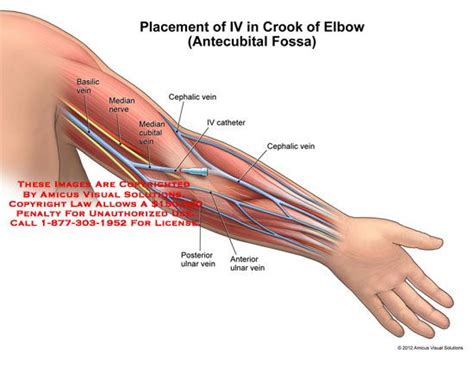 antecubital fossa - Google Search | Median nerve, Medical experts, Medical transcription