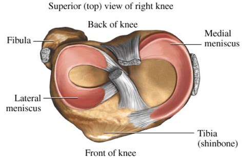 What Is a Torn Meniscus in the Knee & How Do I Treat It?