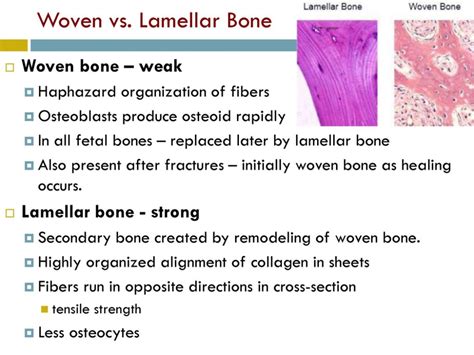 lamellar bone nd woven difference - Google Search | Woven, Bones, Healing