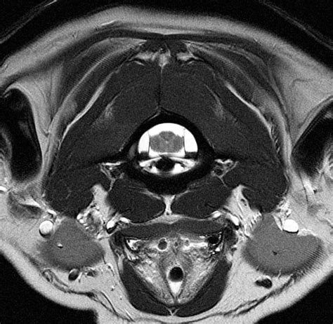 Canine Brain MRI Atlas - 20130233 - University of Minnesota Office for ...