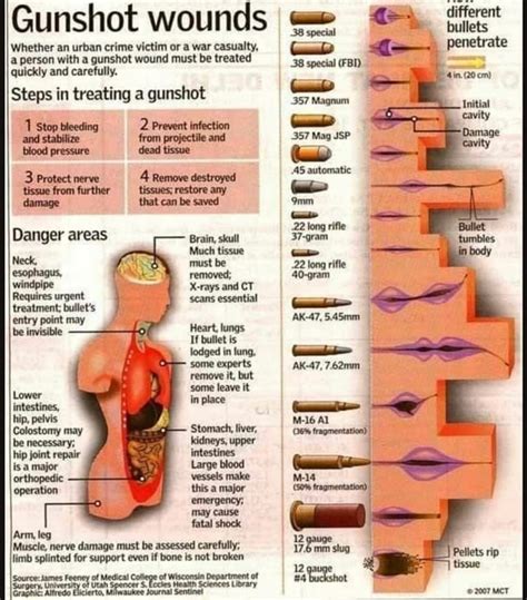 A diagram of what different bullets do to you and how to treat a bullet ...