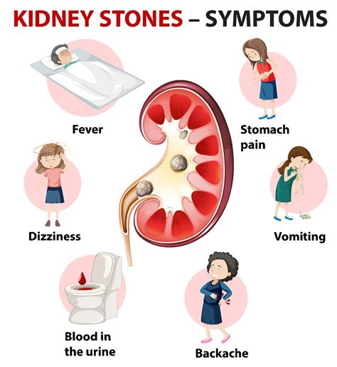 Kidney stones symptoms cartoon style infographic 1929376 Vector Art at Vecteezy