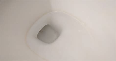 How do I clean a toilet ring? : CleaningTips