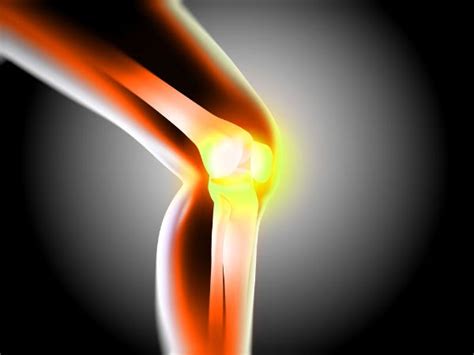 Osteomalacia: Causes, Symptoms, Risk Factors, Diagnosis & Treatment ...