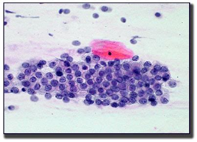 Normal Cytology | Wisconsin State Laboratory of Hygiene