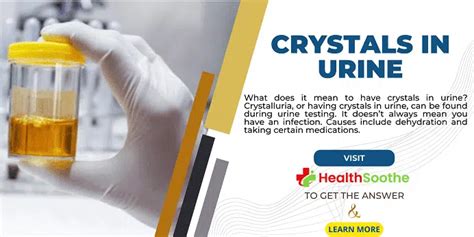 Crystals In Urine | Find Out What Causes This, The Symptoms, Treatments ...