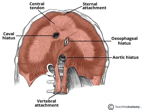 Hiatus Hernia - Rolling - Sliding - Management - TeachMeSurgery