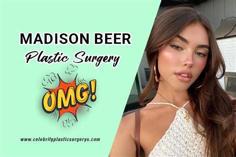 Madison Beer Plastic Surgery Before And After Pics Revealed