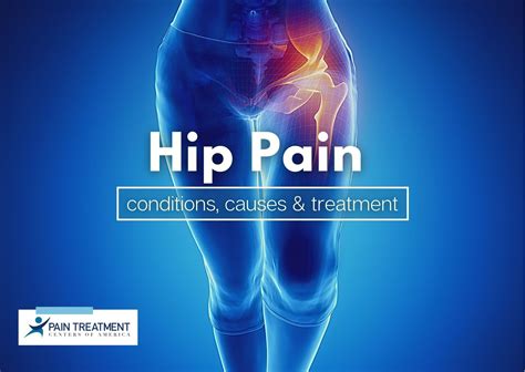 An Overview of Hip Pain: Conditions, Causes & Treatment | PTCOA