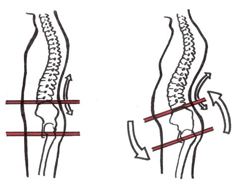 Muscle Exercise: Muscle Imbalance Exercises