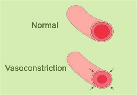 What is vasoconstriction ? definition, hypoxic and peripheral, causes